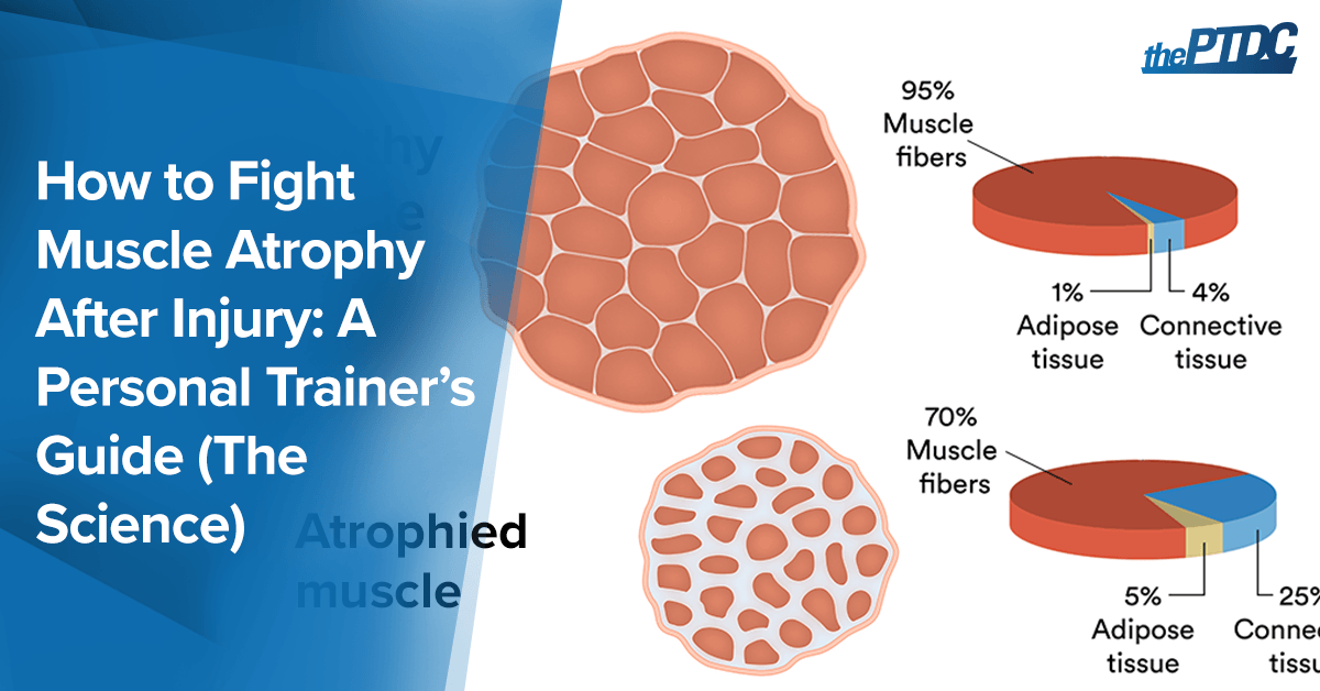 how-to-fight-muscle-atrophy-after-injury:-a-personal-trainer’s-guide